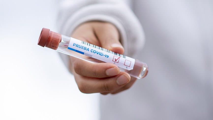 prueba coronavirus