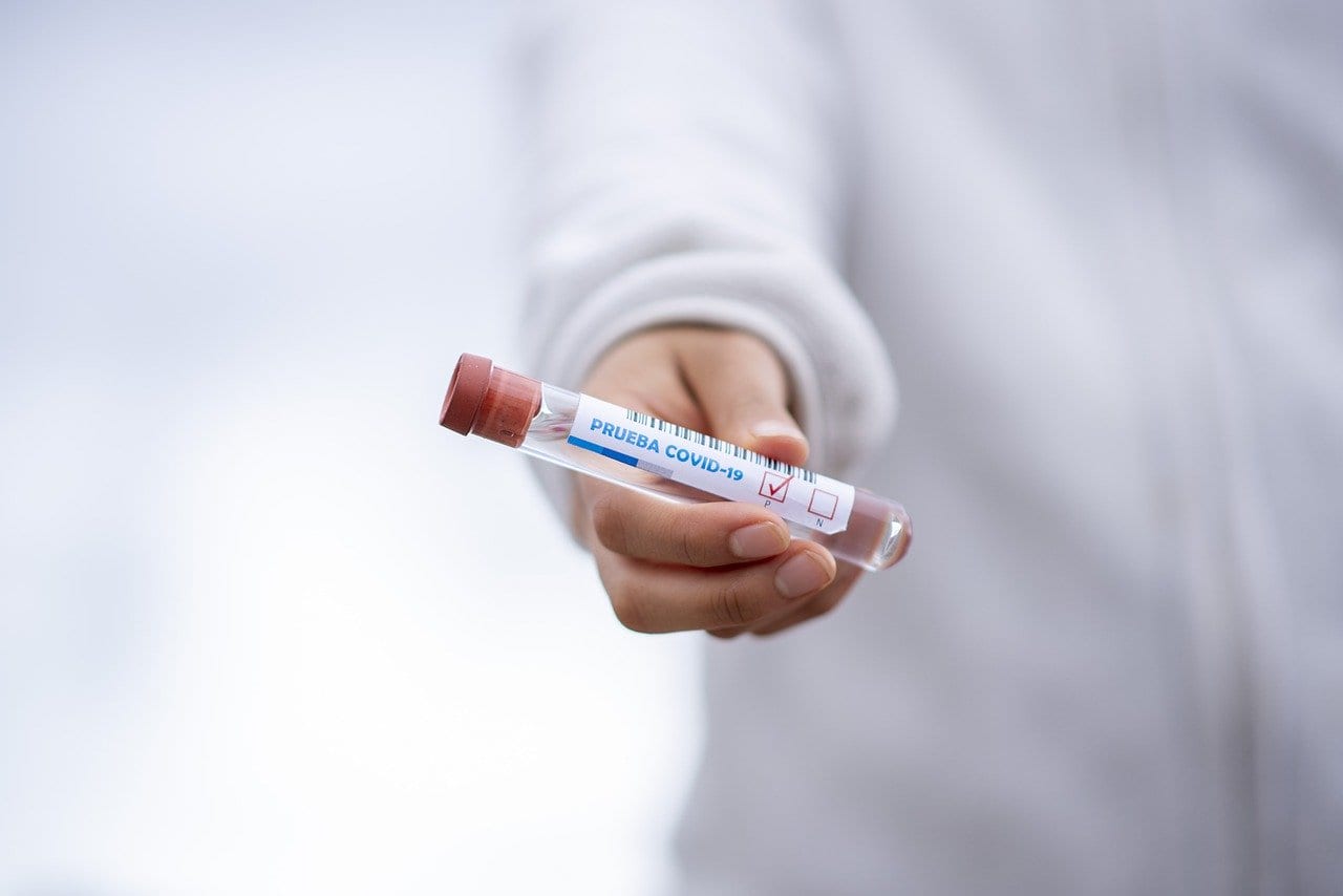 test-tube-5065426_1280(1)